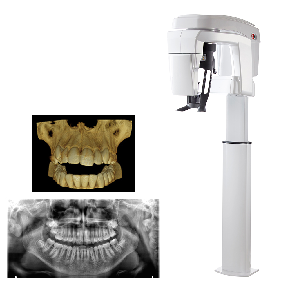 CT・パノラマサブスクプラン（KR-8200 3D） | krix